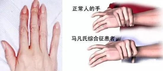 廈門(mén)眼科中心