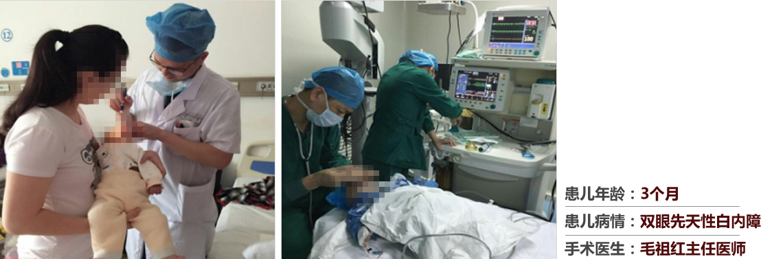 患兒年齡：3個月，患兒病情：雙眼先天性白內(nèi)障，手術(shù)醫(yī)生：毛祖紅主任醫(yī)師
