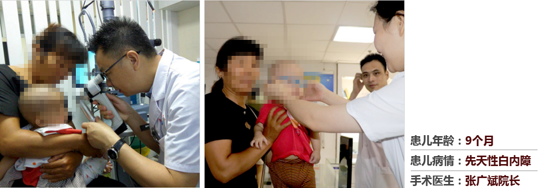 患兒年齡：9個月，患兒病情：先天性白內(nèi)障，手術(shù)醫(yī)生：張廣斌院長