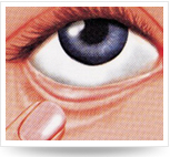 頭仰后，用食指將下眼瞼下拉，使其成袋狀